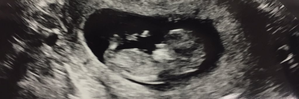 Charlie Mahon banner