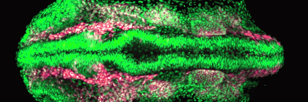 Victoria Prince banner