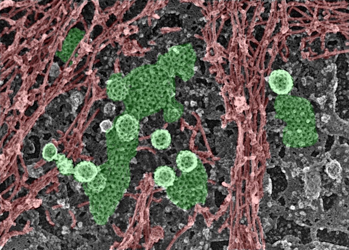 Steeve Boulant banner