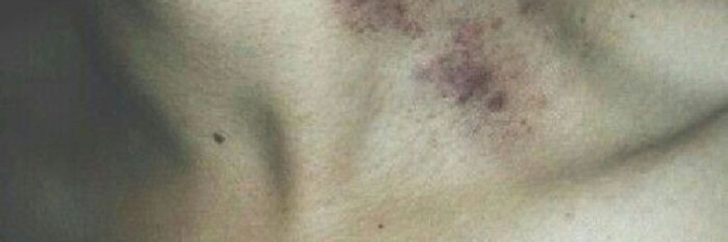 X banner