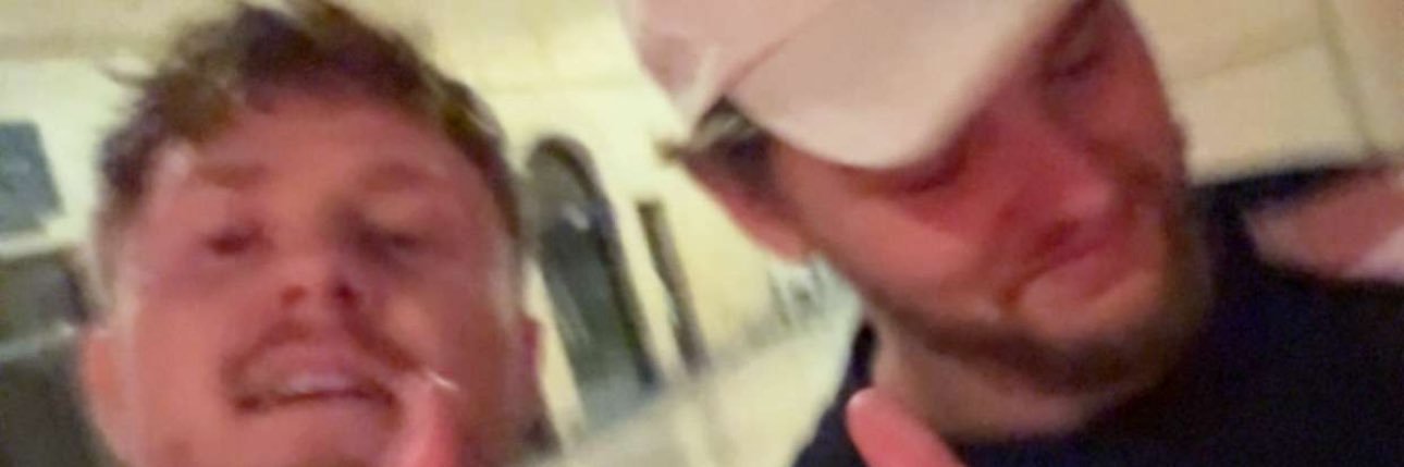 Nozy banner