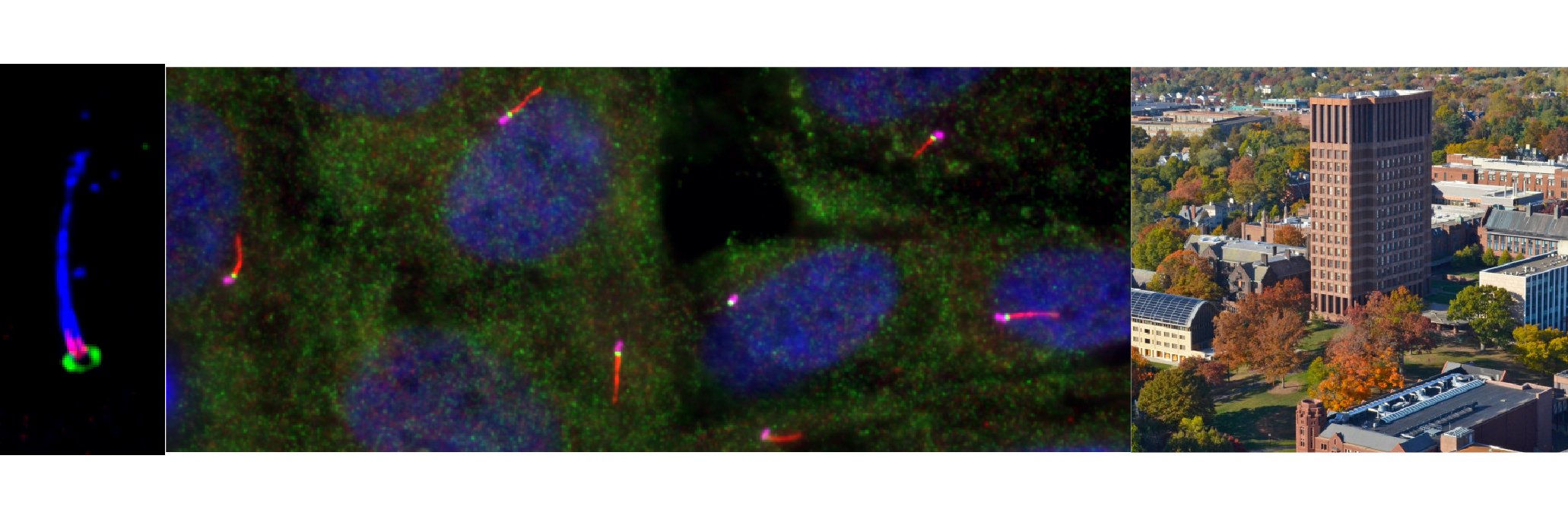 David Breslow lab banner