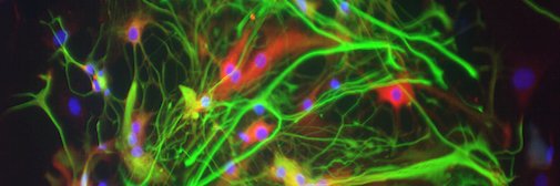 Ulrich Schüller banner