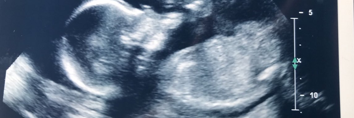 NormSauce's profile banner image