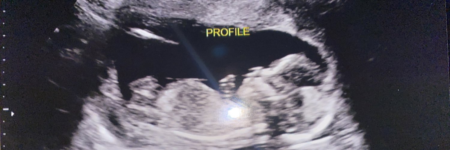 ItsMeMe_btw's profile banner image
