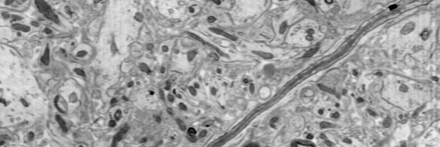 Alexandra Pacureanu banner