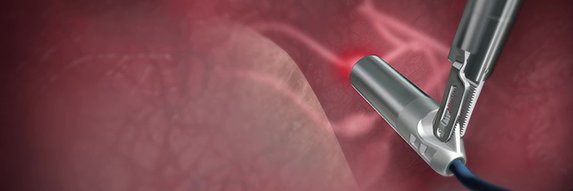 Lightpoint Medical banner