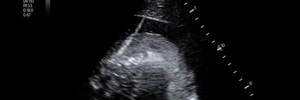 POCUSaurusRex Profile Banner