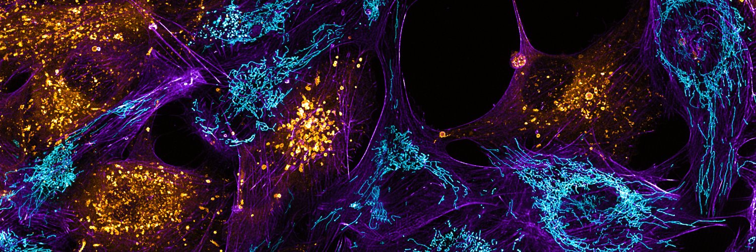 Reuben Philip banner