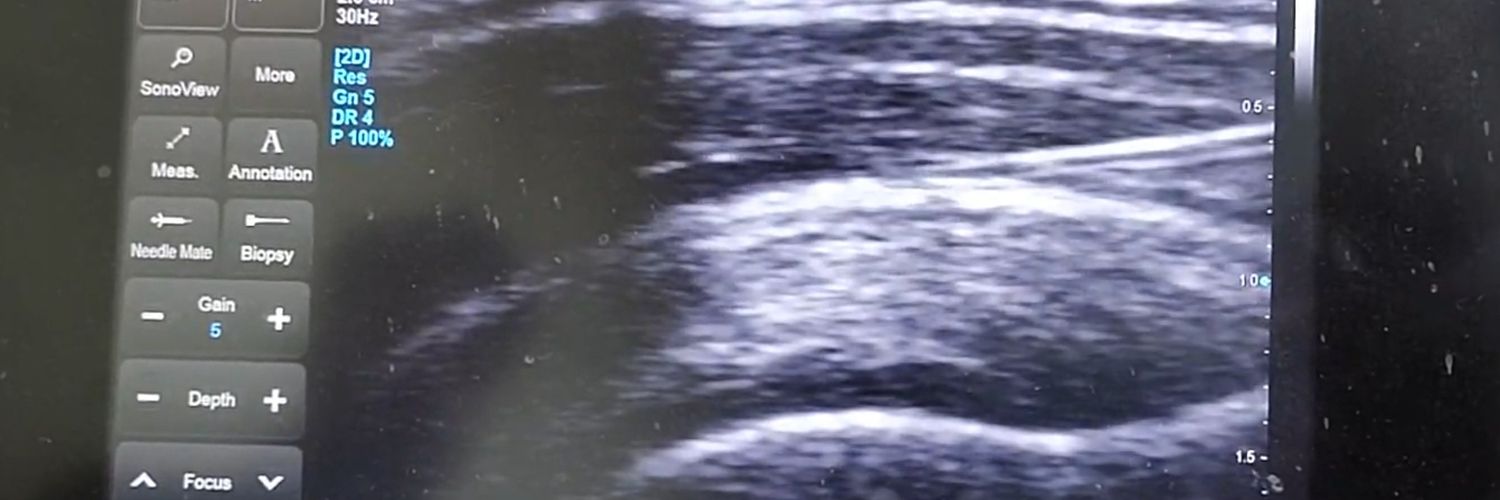 Dr. Anindya Basu MD banner