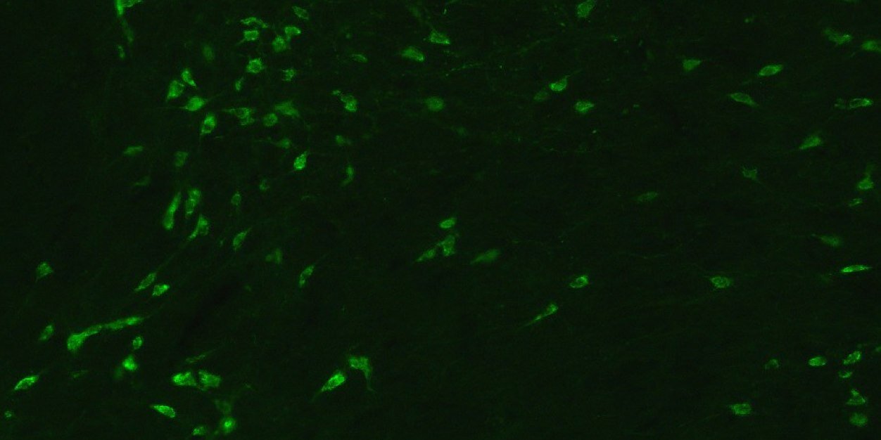 Pablo Torterolo banner