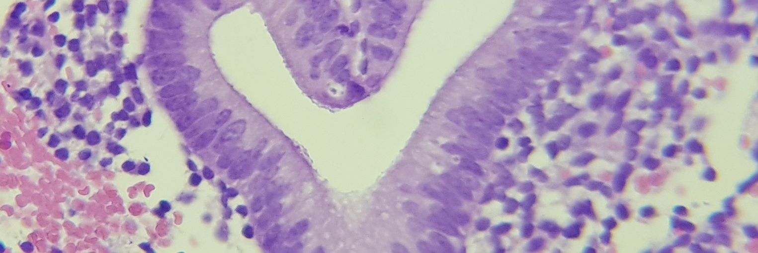 Idaira J. Expósito banner