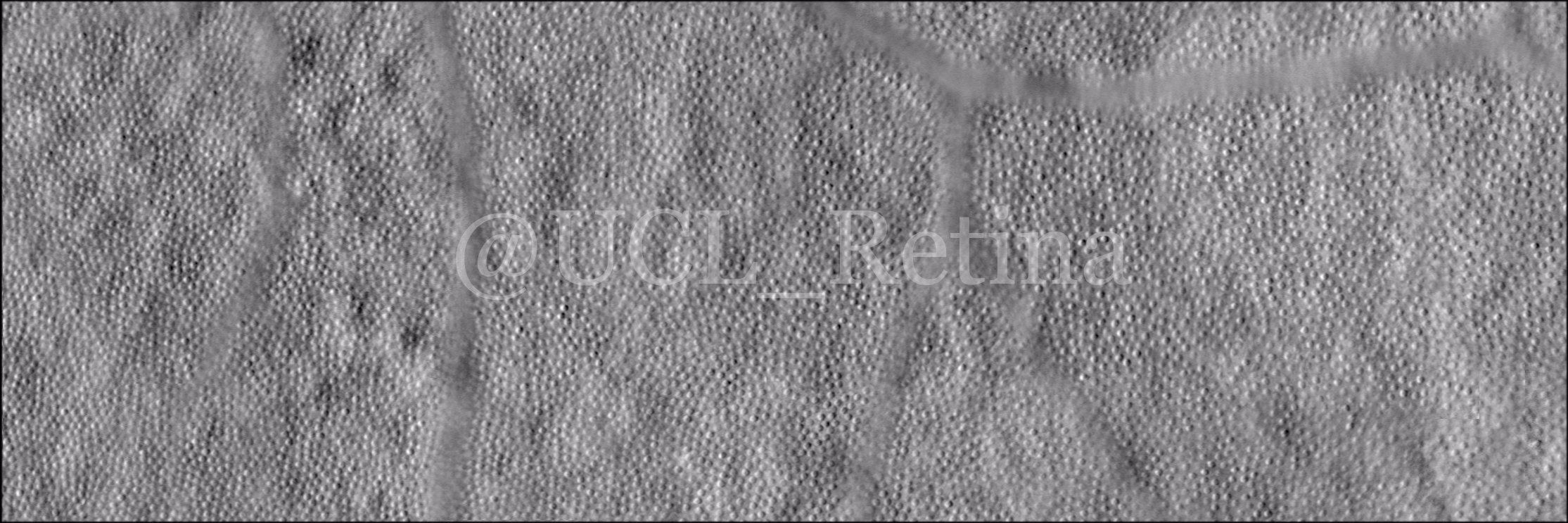 UCL Retinal Phenotyping banner