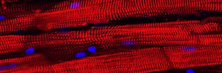 Samuel Watson banner