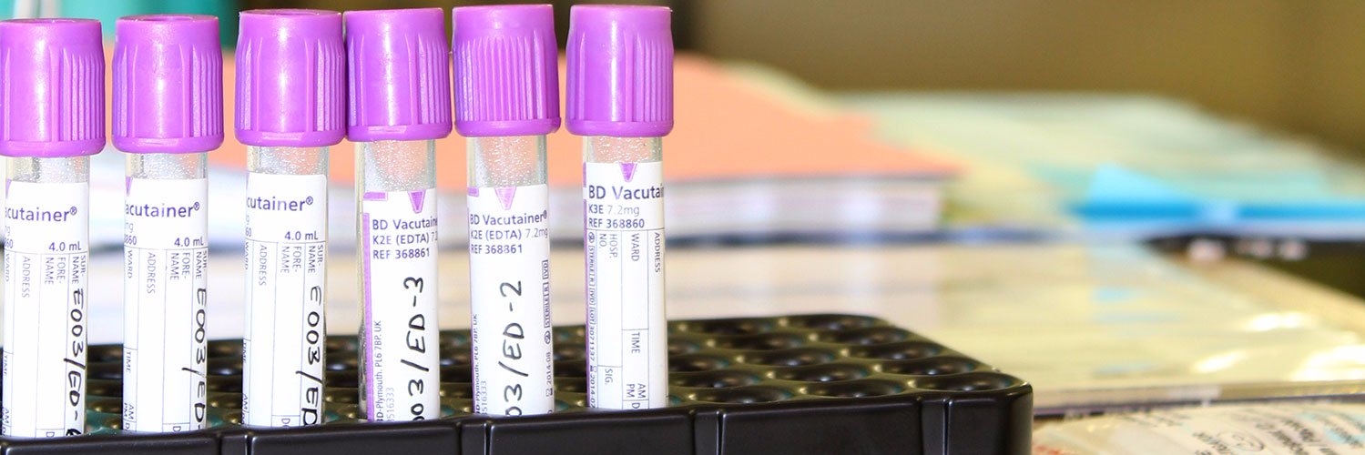 UCT-MRC CCOAT banner