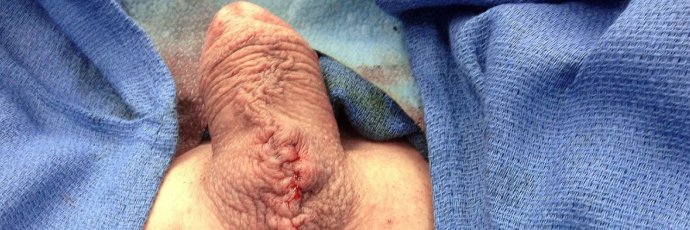 西安奴-前锁后塞-上下穿环 banner