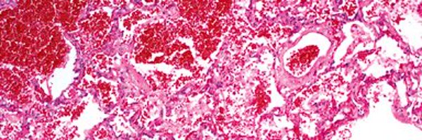 Acute_Pulmo_Med Profile Banner