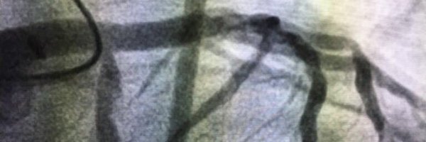 ZeroTLR Profile Banner