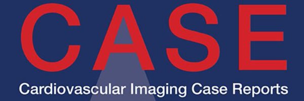 CASEfromASE Profile Banner