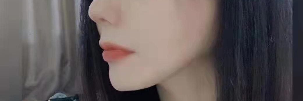 红豆（互粉） banner