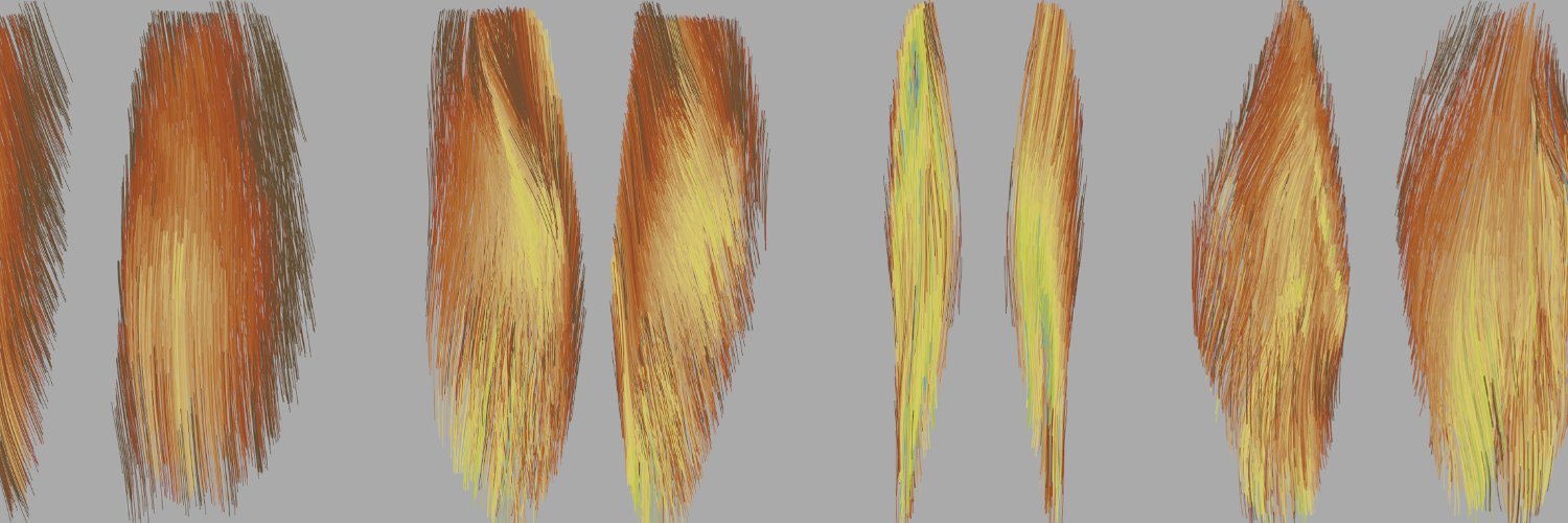 Martijn Froeling banner