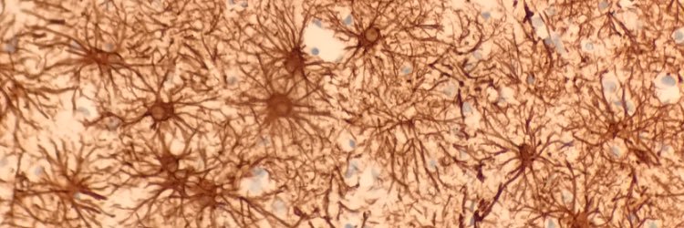 Jared T. Ahrendsen MD, PhD (AP/NP/FP) banner