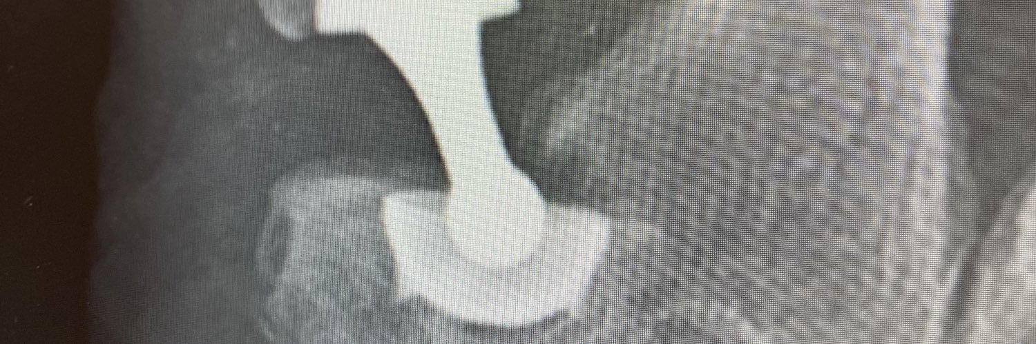 Mr Andy Hacker banner