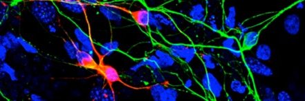 Dra. Alba Tristán-Noguero banner