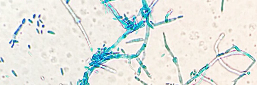 Amy Brotherton, PharmD banner