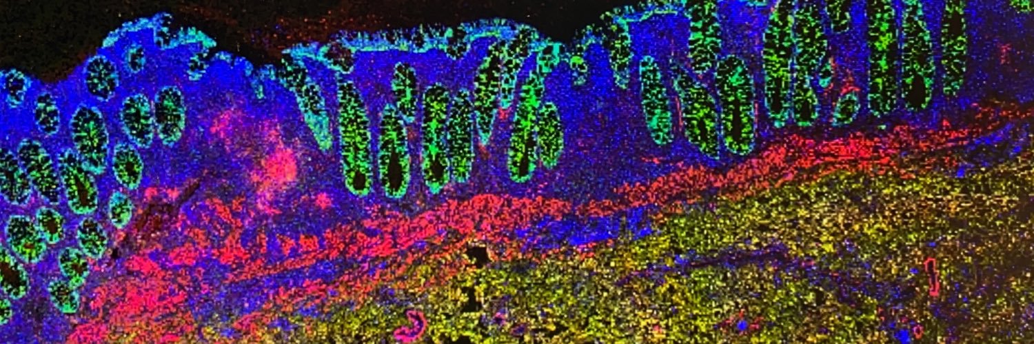 Kristen Rumer banner