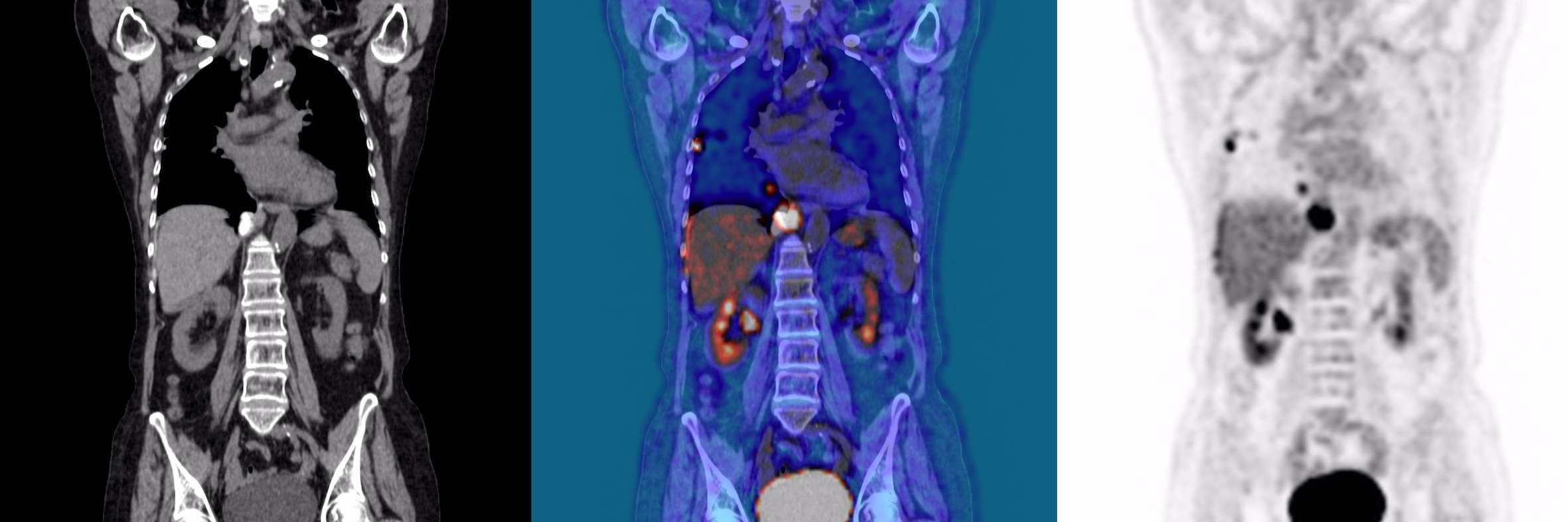 Leeds Radiotherapy Research 💙 banner