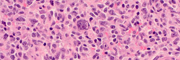 TheLymphomaniac Profile Banner