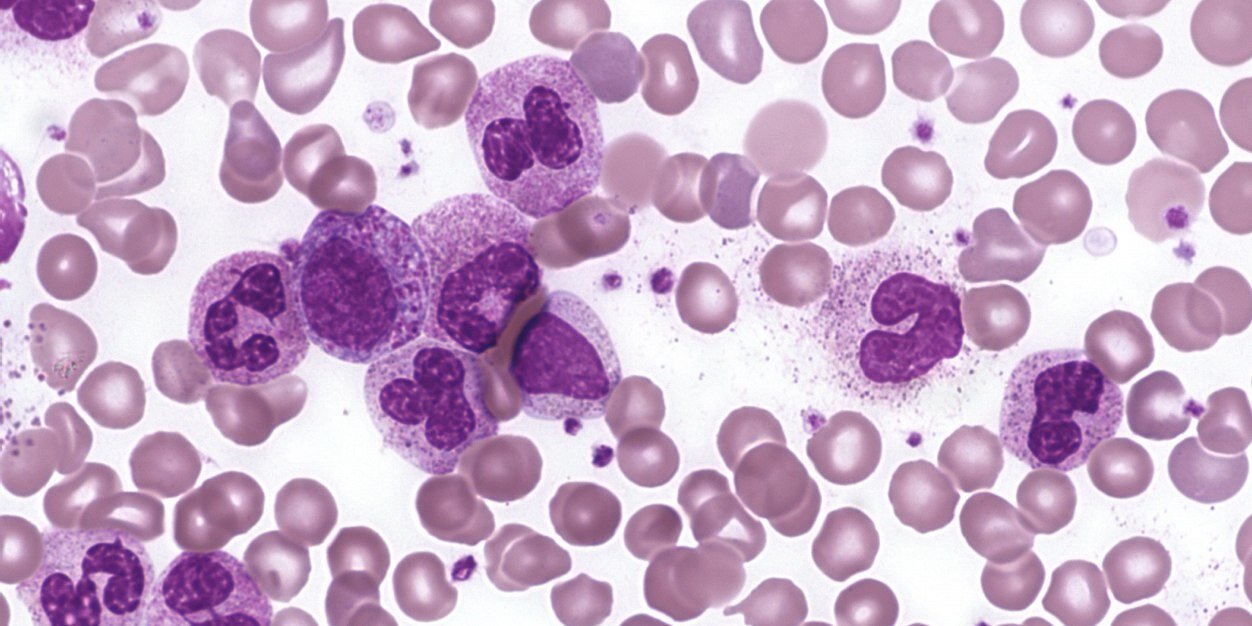 Adam Forman, MD 🩸 banner