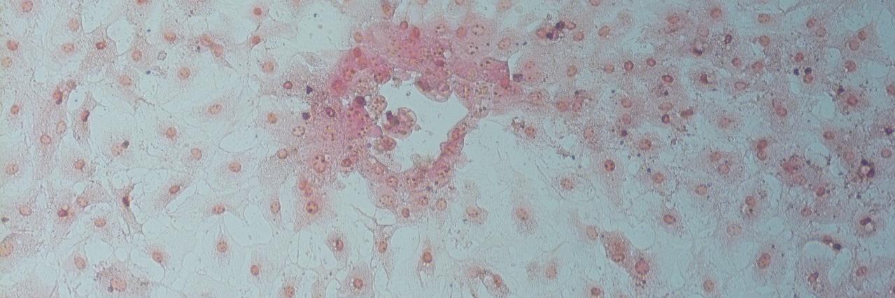 Laura Masters banner