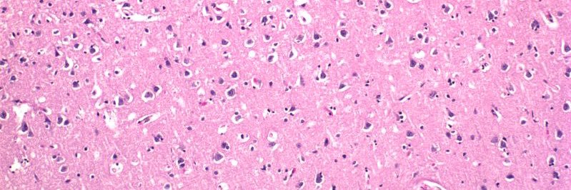 Thomas Millner banner