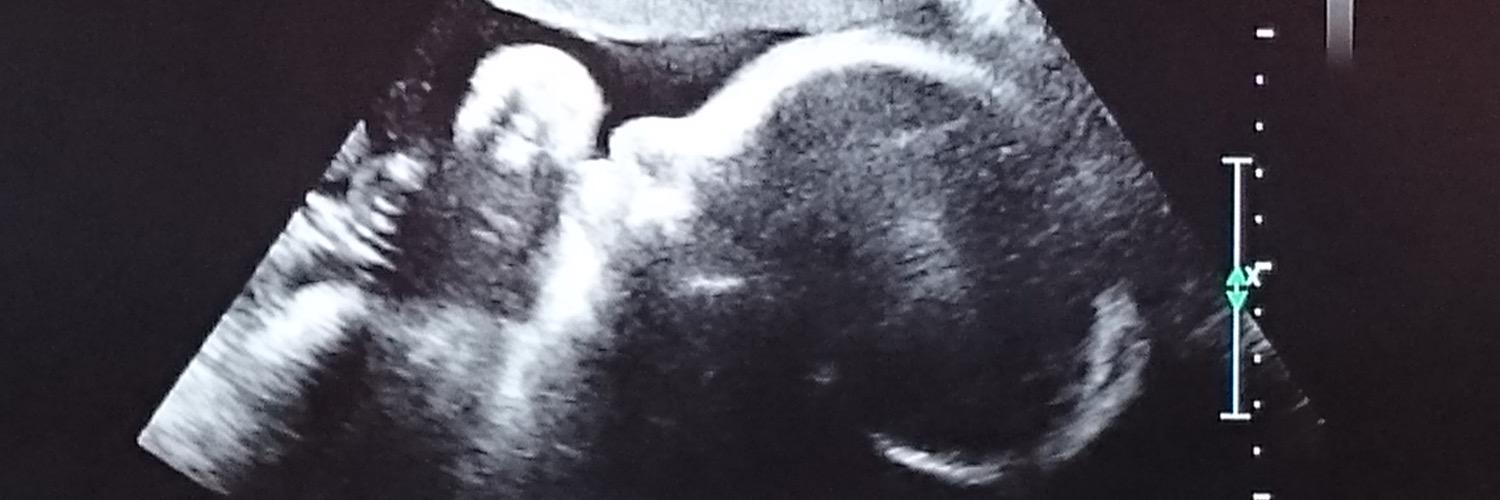 StickyJonz's profile banner image