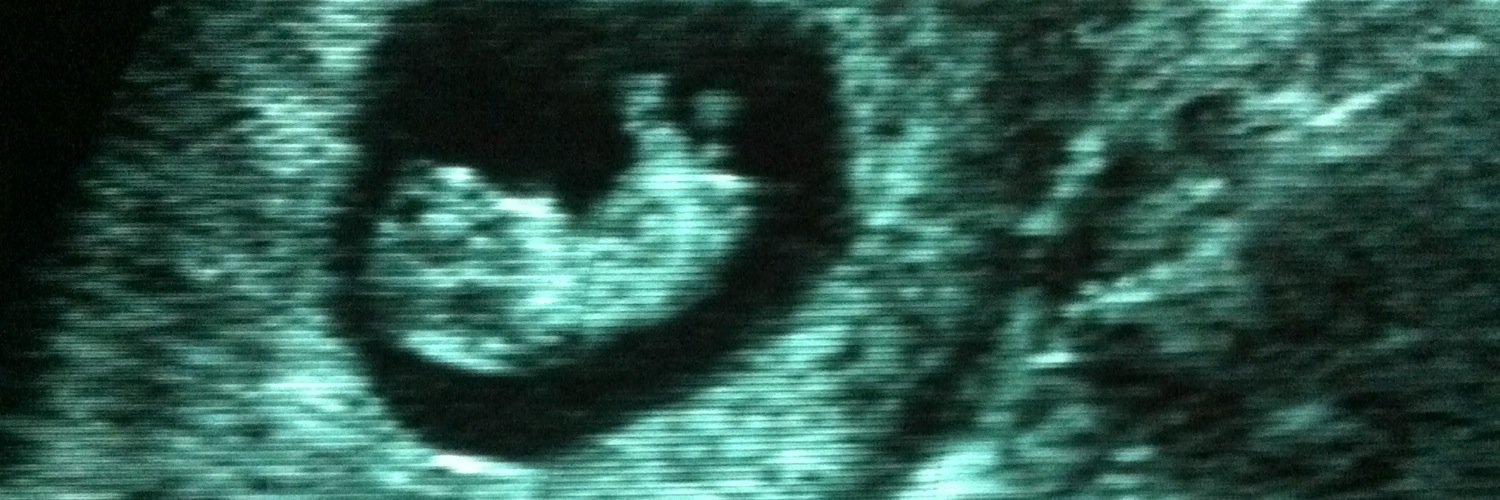 UltraDiag's profile banner image