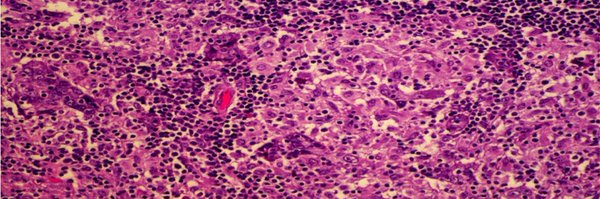 TILsWorkGroup Profile Banner