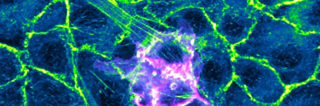 Shilpa Pothapragada banner