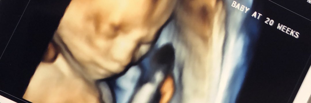 jaycee_carrera's profile banner image