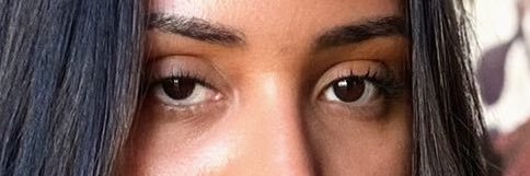 Lesionado 🤍 banner