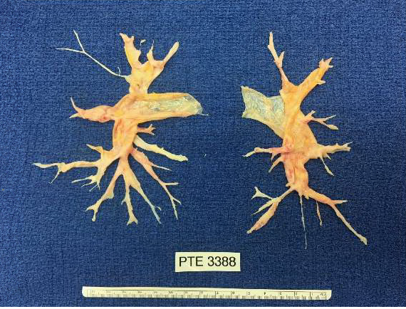 Timothy Fernandes, MD, MPH banner