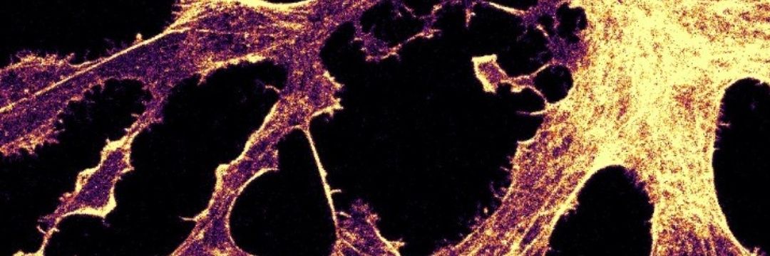 Meera Chandra banner