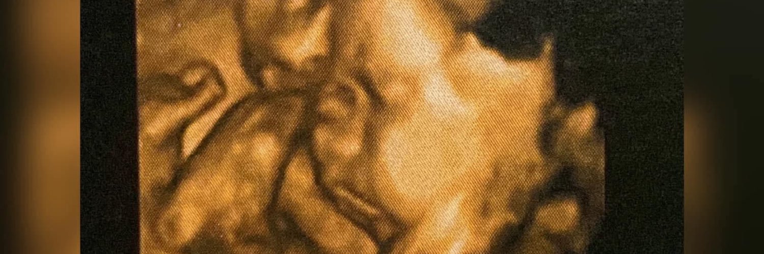 23Seibert's profile banner image