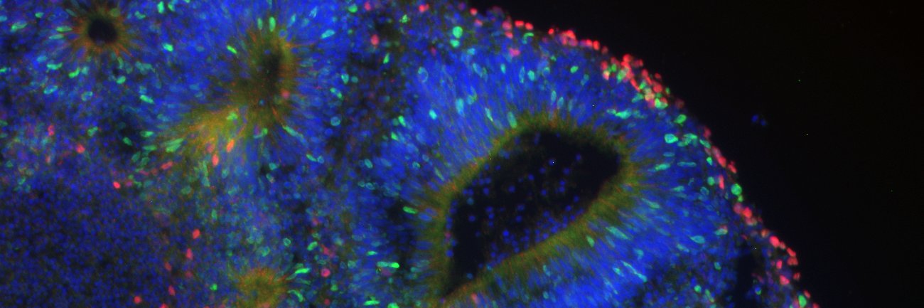 Astrid van der Geest banner