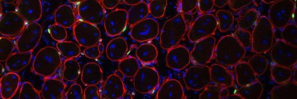 ELM_ELM_ELM_ELM Profile Banner