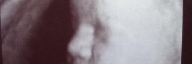 CrazyADaDon's profile banner image