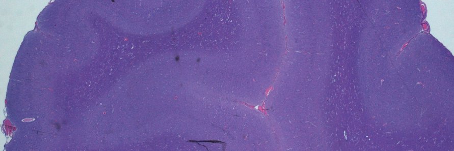 My Neuropath News's banner