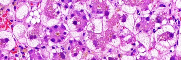 LiverPath_HPHS Profile Banner