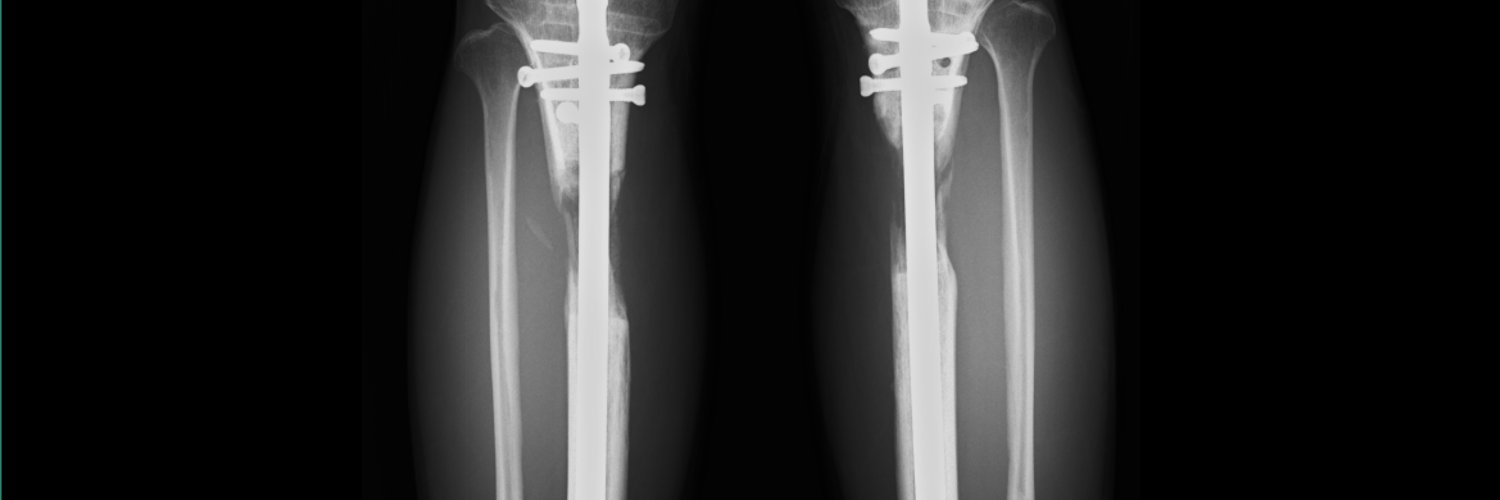 はるきち🐴 サイボーグ banner